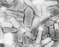 Ιός λύσσας - ηλεκτρονικό μικροσκόπιο Ιός λύσσας - εικόνα από ηλεκτρονικό μικροσκόπιο