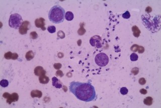 Κύτταρα μολυσμένα με λεϊσμάνια: εικόνα από μικροσκόπιο