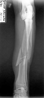 Προσθοπίσθια ακτινογραφία αντιβραχίου σκύλου: συντριπτικό κάταγμα